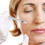 How Many Units Of Botox Do You Need? Expert Insights At New You Medical Center In Richmond, TX